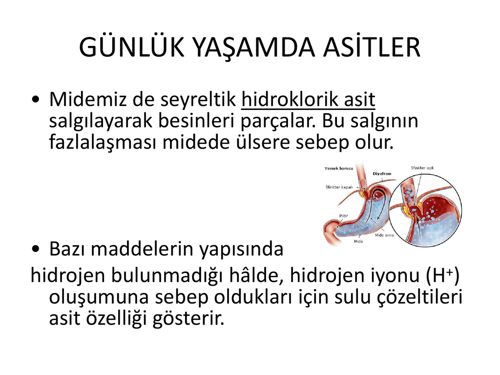 Ülser neden olur ile Etiketlenen Konular Ülser neden olur ile Etiketlenen Konular